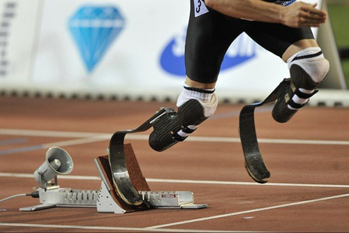 安裝假肢去鄭州哪個假肢廠家公司比較好呢(圖1) 安裝假肢去鄭州哪個假肢廠家公司比較好呢(圖1)