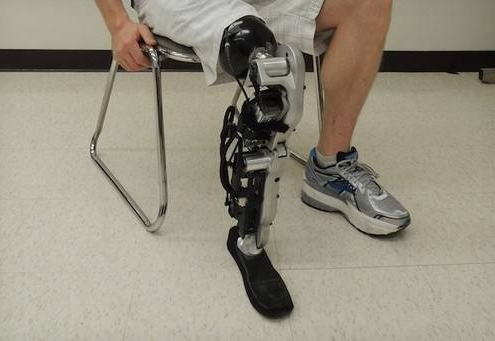 穿戴假肢過程中出現(xiàn)疼痛是怎么回事鄭州力康假肢廠家(圖1) 穿戴假肢過程中出現(xiàn)疼痛是怎么回事鄭州力康假肢廠家(圖1)