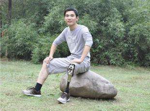 河南假肢淺談安裝假肢做好護(hù)理的重要性(圖1) 假肢